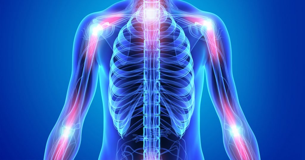 castor oil as Anti-Inflammatory