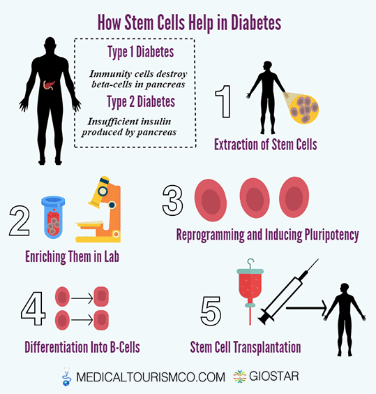 how Stem Cells Cure Diabetes