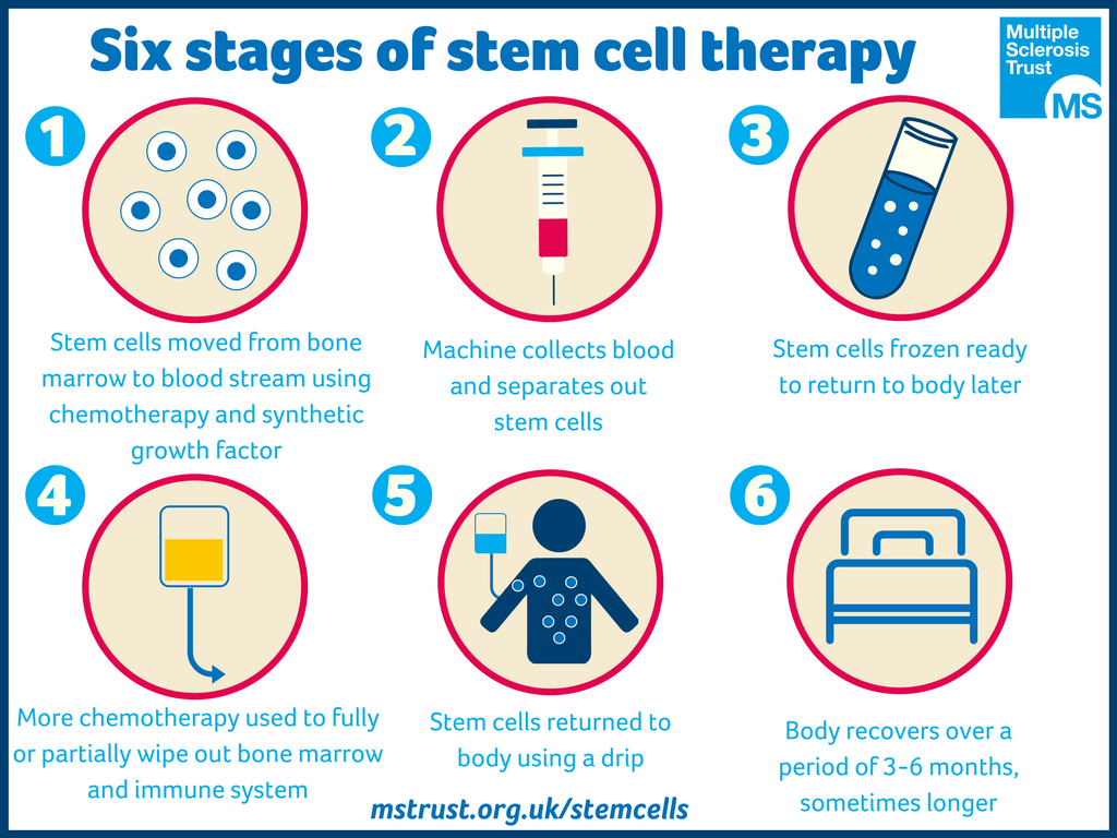 Stages in Stem Cell Therapy